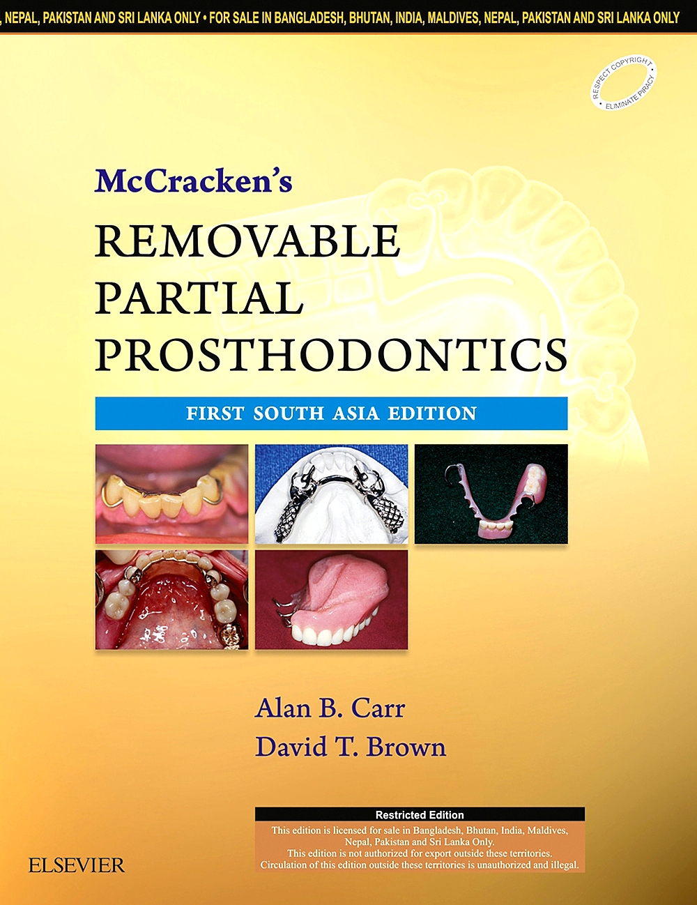 McCracken'S Removable Partial Prosthodontics 1E AryaBook